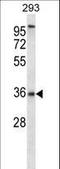 Pyrimidinergic Receptor P2Y6 antibody, LS-C163323, Lifespan Biosciences, Western Blot image 