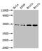 Gap Junction Protein Alpha 8 antibody, CSB-PA009449LA01HU, Cusabio, Western Blot image 