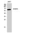 SUMO Specific Peptidase 2 antibody, A02329, Boster Biological Technology, Western Blot image 