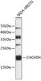Coiled-Coil-Helix-Coiled-Coil-Helix Domain Containing 4 antibody, 23-861, ProSci, Western Blot image 