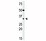 Snail Family Transcriptional Repressor 2 antibody, F47911-0.4ML, NSJ Bioreagents, Western Blot image 