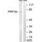 Pre-MRNA Processing Factor 39 antibody, PA5-50093, Invitrogen Antibodies, Western Blot image 