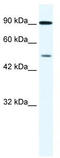 Zinc Finger Protein 175 antibody, TA339444, Origene, Western Blot image 