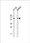 Cholinergic Receptor Muscarinic 3 antibody, PA5-72320, Invitrogen Antibodies, Western Blot image 