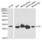 CA-II antibody, abx001239, Abbexa, Western Blot image 