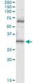 Prodynorphin antibody, H00005173-M01, Novus Biologicals, Immunoprecipitation image 