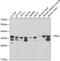 Tropomyosin 1 antibody, 14-051, ProSci, Western Blot image 