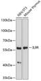 Interleukin 9 Receptor antibody, 22-364, ProSci, Western Blot image 