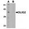 Oligodendrocyte Transcription Factor 2 antibody, MBS153343, MyBioSource, Western Blot image 
