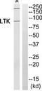 Leukocyte Receptor Tyrosine Kinase antibody, TA314163, Origene, Western Blot image 