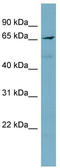 5 -AMP-activated protein kinase catalytic subunit alpha-2 antibody, TA345140, Origene, Western Blot image 