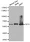 Carboxylesterase 1 antibody, abx001532, Abbexa, Western Blot image 