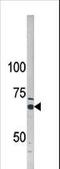 AarF Domain Containing Kinase 5 antibody, LS-C98090, Lifespan Biosciences, Western Blot image 