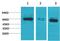 Bestrophin 1 antibody, A01434, Boster Biological Technology, Western Blot image 