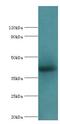 AlkB Homolog 1, Histone H2A Dioxygenase antibody, LS-B15213, Lifespan Biosciences, Western Blot image 