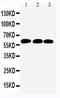 SMAD Family Member 4 antibody, PA5-80038, Invitrogen Antibodies, Western Blot image 