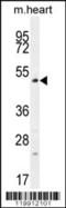 TSPY Like 4 antibody, 56-224, ProSci, Western Blot image 