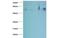 Complement Factor B antibody, MBS839695, MyBioSource, Western Blot image 
