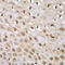 Integrator Complex Subunit 5 antibody, 15-126, ProSci, Immunohistochemistry paraffin image 