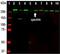 Spectrin alpha chain, brain antibody, M03831, Boster Biological Technology, Western Blot image 