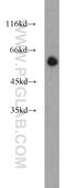 POPDC3 antibody, 11800-1-AP, Proteintech Group, Western Blot image 