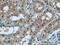 Protein Phosphatase 2 Scaffold Subunit Aalpha antibody, 15882-1-AP, Proteintech Group, Immunohistochemistry frozen image 