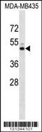 Potassium Voltage-Gated Channel Subfamily J Member 13 antibody, 56-388, ProSci, Western Blot image 