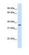 Aldo-Keto Reductase Family 1 Member B10 antibody, orb330244, Biorbyt, Western Blot image 