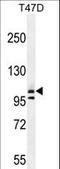 Collagen Type I Alpha 2 Chain antibody, LS-C166923, Lifespan Biosciences, Western Blot image 