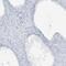 Scm Polycomb Group Protein Like 1 antibody, PA5-57206, Invitrogen Antibodies, Immunohistochemistry frozen image 