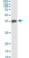 Protein Activator Of Interferon Induced Protein Kinase EIF2AK2 antibody, H00008575-M01, Novus Biologicals, Immunoprecipitation image 