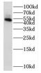 NOP2/Sun RNA Methyltransferase 5 antibody, FNab05871, FineTest, Western Blot image 