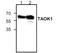 TAO Kinase 1 antibody, GTX59887, GeneTex, Western Blot image 