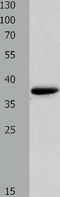 Myozenin 1 antibody, TA322227, Origene, Western Blot image 