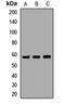 Cholinergic Receptor Nicotinic Gamma Subunit antibody, LS-C667679, Lifespan Biosciences, Western Blot image 