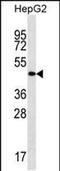 Transmembrane And Coiled-Coil Domain Family 3 antibody, PA5-48556, Invitrogen Antibodies, Western Blot image 