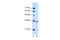 Activin A Receptor Type 2B antibody, 30-044, ProSci, Western Blot image 