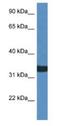 Alkaline Ceramidase 1 antibody, NBP1-74083, Novus Biologicals, Western Blot image 