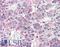 Prolactin Releasing Hormone Receptor antibody, LS-A1088, Lifespan Biosciences, Immunohistochemistry frozen image 