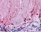 Lin-28 Homolog A antibody, LS-B5073, Lifespan Biosciences, Immunohistochemistry paraffin image 