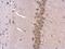 Rho Associated Coiled-Coil Containing Protein Kinase 2 antibody, GTX122652, GeneTex, Immunohistochemistry paraffin image 