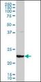 Glutathione S-transferase alpha-3 antibody, orb89606, Biorbyt, Western Blot image 