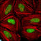 Checkpoint Kinase 2 antibody, LS-C814008, Lifespan Biosciences, Western Blot image 