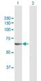 VPS18 Core Subunit Of CORVET And HOPS Complexes antibody, H00057617-D01P, Novus Biologicals, Western Blot image 