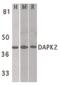 Death Associated Protein Kinase 2 antibody, PA5-19961, Invitrogen Antibodies, Western Blot image 