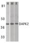 Death Associated Protein Kinase 2 antibody, PA5-19961, Invitrogen Antibodies, Western Blot image 