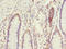 Eukaryotic Translation Initiation Factor 2B Subunit Beta antibody, LS-C675696, Lifespan Biosciences, Immunohistochemistry paraffin image 