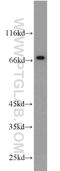 Sperm Associated Antigen 16 antibody, 16883-1-AP, Proteintech Group, Western Blot image 