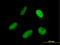 Signal Recognition Particle 68 antibody, LS-C198264, Lifespan Biosciences, Immunofluorescence image 