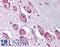 Gamma-Aminobutyric Acid Type A Receptor Alpha3 Subunit antibody, LS-A9667, Lifespan Biosciences, Immunohistochemistry frozen image 